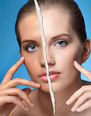 New_Size_iStock_000009622833_Small